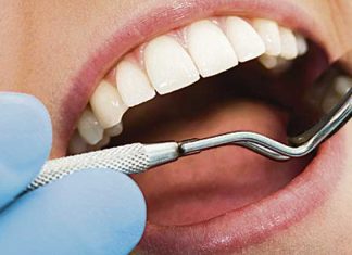 El Tribunal Supremo dictamina que un protésico dental no puede colocar prótesis ni tomar medidas de la boca