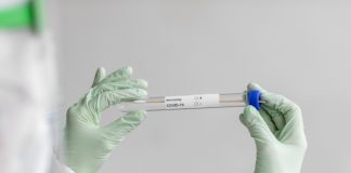 Repunte de contagios en Extremadura, con 398 positivos