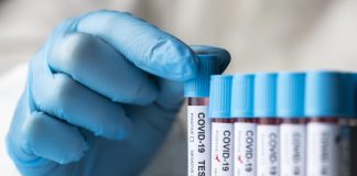 Coronavirus en extremadura: 45 positivos y una mujer fallecida